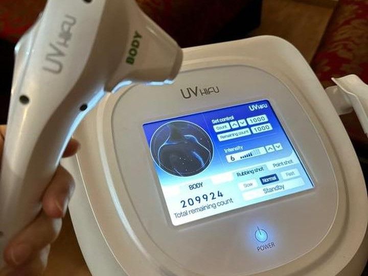ハイフ(UV FIFU、高周波機械管理)
