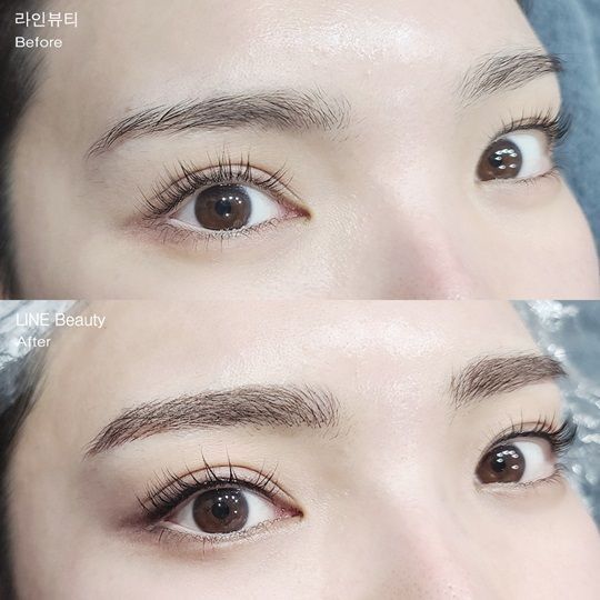 ライン皮膚科医院(アートメイク・プチ整形)｜江南駅・三成(COEX