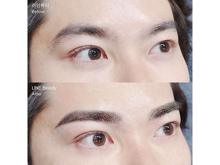 ライン皮膚科医院(アートメイク・プチ整形)｜江南駅・三成(COEX