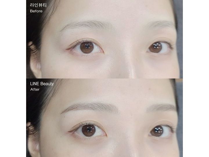 ライン皮膚科医院(アートメイク・プチ整形)｜江南駅・三成(COEX