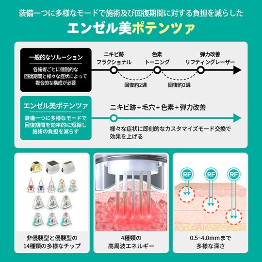 エンゼル美医院のポテンツァの特徴