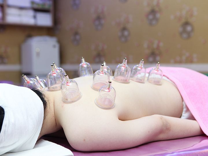 首や肩のコリが気になるなら「カッピング」