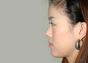 金鐘瑞 キム ジョンソ 美容外科 狎鴎亭 清潭洞 ソウル の美容医療 クリニック 韓国旅行 コネスト