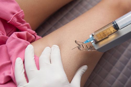 脂肪分解注射イメージ