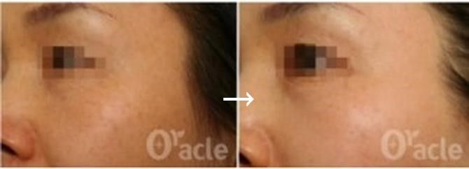 チョンダムオラクル皮膚科医院｜江南駅・三成(COEX)(ソウル)の美容医療