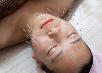 明るくハリのある美肌に導く童顔鍼